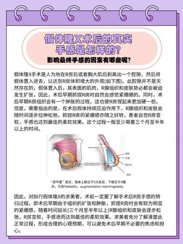 假體Do前你要知道的幾件事