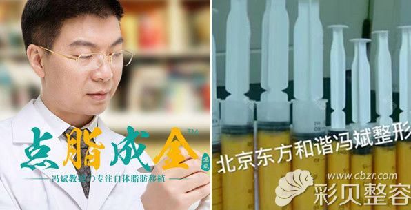 北京純脂馮斌院長和我抽出來10斤脂肪的圖片