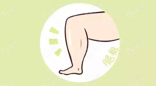 广州王世虎抽脂实例23/6z.com