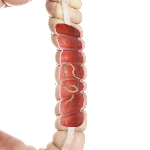 蛔蟲(chóng)會(huì)影響身體健康嗎