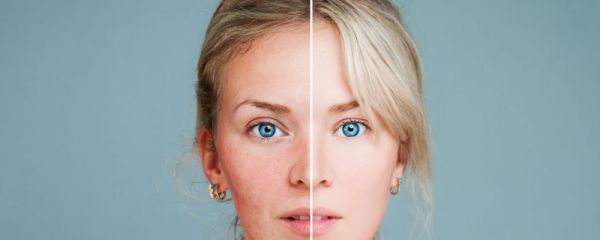 什么是断糖减肥法 断糖减肥法的好处 断糖减肥法优势