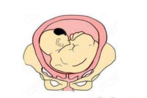 如何運(yùn)用運(yùn)動(dòng)來(lái)進(jìn)行產(chǎn)后塑身