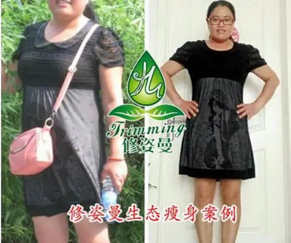 修姿曼生态瘦身加盟