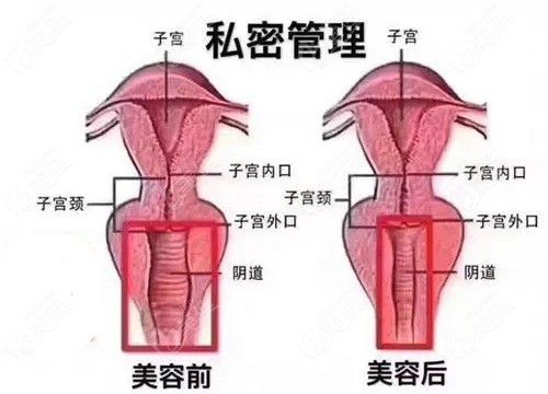 韓國(guó)私密整形前后對(duì)比