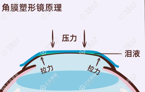 兒童戴OK鏡好的牌子排名@hryjz.com