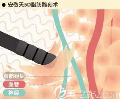 韓國純真5d脂肪雕刻術(shù)