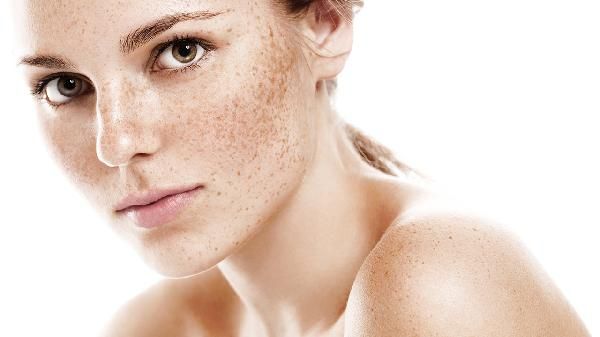 哺乳期脸上的斑越来越严重是为什么