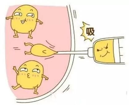 腹部吸脂示意圖