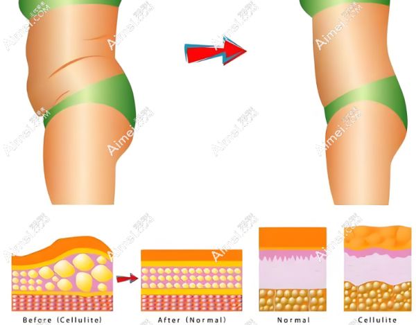 國(guó)內(nèi)腰腹環(huán)吸醫(yī)院排名前十名榜單介紹www.aimei.com