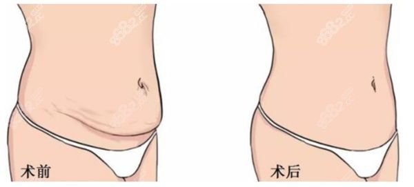 深圳陽(yáng)光整形美容醫(yī)院怎么樣