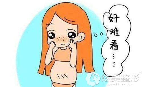 腹部吸脂打算抽1000ml脂肪,要打多少肿胀液才是安全的