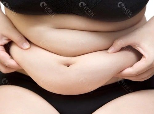 腹部吸脂肪多少钱