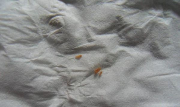 貓咪屁屁有蛔蟲（寵物健康的重要性與應(yīng)對蛔蟲的方法）
