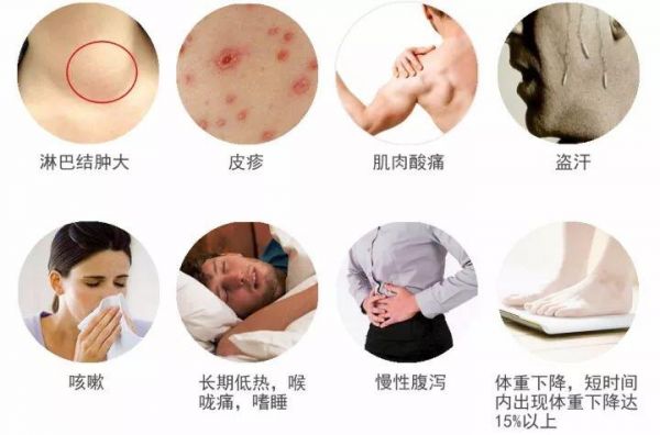艾滋病多久會開始暴瘦