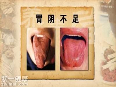 从舌苔看出体质的症状 中医教你如何从舌苔辨别健康状况【图】