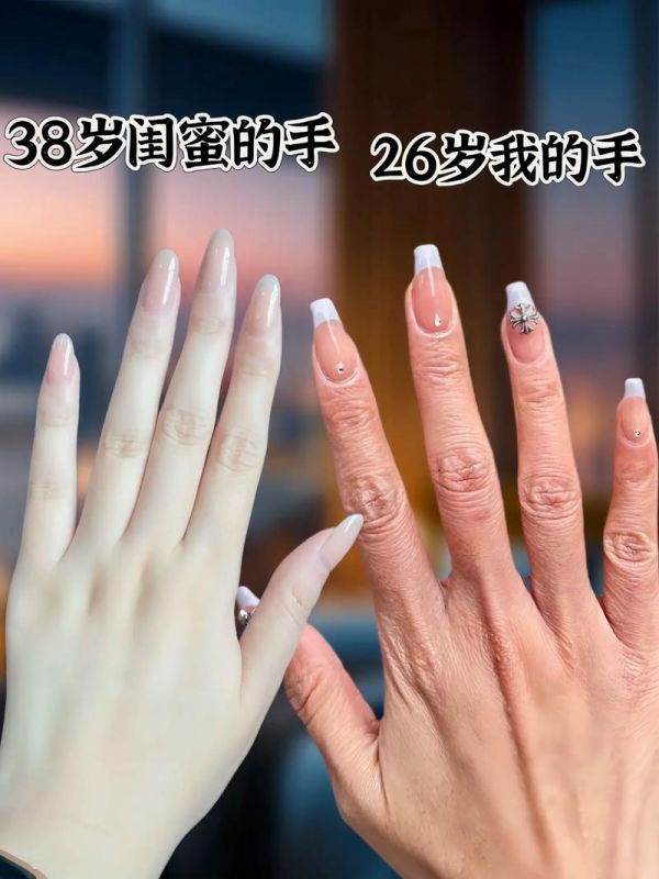 用什么護膚保養(yǎng)手部