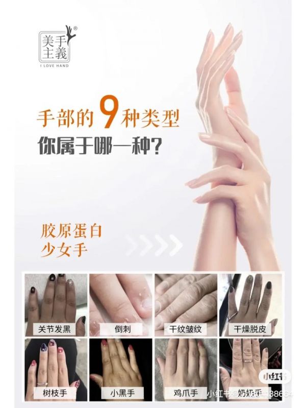 护肤手部保养方法有哪些