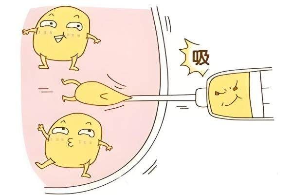 西安朱健康做脂肪填充怎么樣