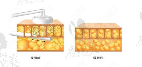 南京美贝尔陈刚擅长做什么
