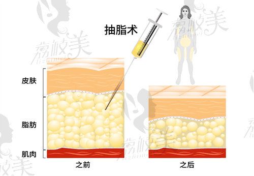 南京美贝尔陈刚擅长做什么