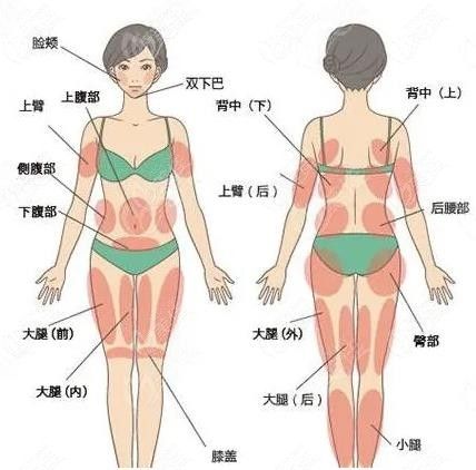 柳州全身吸脂價(jià)格曝光236z.com