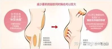 背部痤瘡如何治療_背部減肥_背部和胳膊減肥