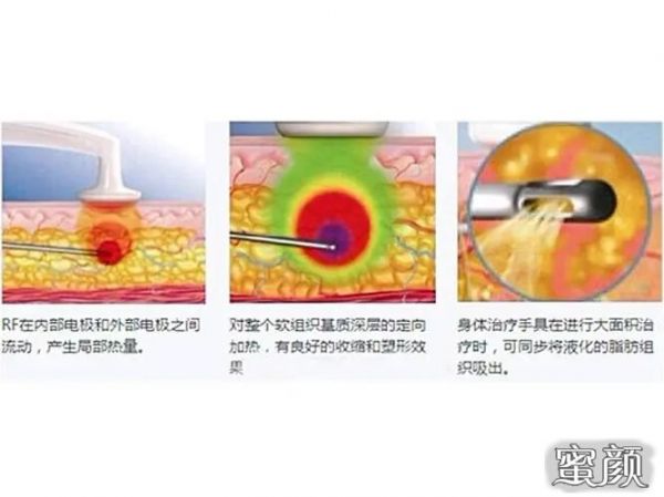 https://img.miyanlife.com/mnt/Editor/2024-01-13/65a22c2e3553e.jpg