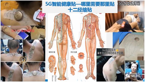 汉方集团5G智能健康贴，在家就能体验美容理疗