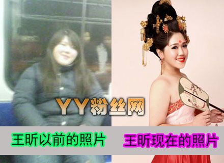 200斤女胖子王昕減肥前后照片對比 王昕整容前后照片對比