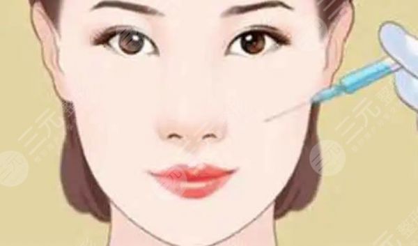下巴填充