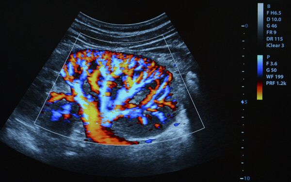 8歲腸套疊是什么原因引起的呢怎么治療