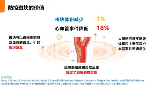 非藥物干預(yù)：NSKSD納豆激酶在血管斑塊管理中的應(yīng)用