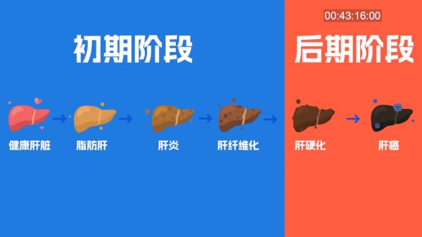 脂肪肝到肝癌僅需4步！福瑞股份FibroScan以精準(zhǔn)篩查守護(hù)肝臟健康