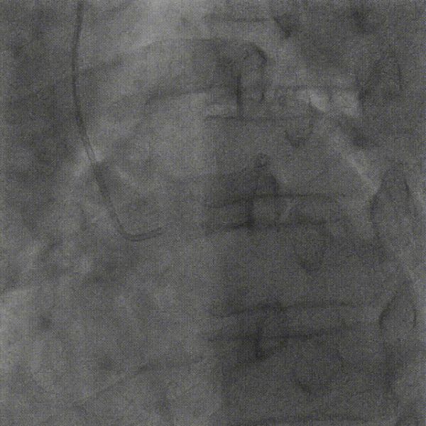 41551678416369672