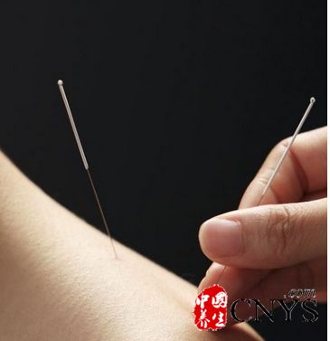 針灸減肥有風險 注意的五大誤區(qū)