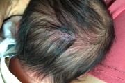 怎么看出自己頭發(fā)是否健康？三種頭皮問題怎么解決