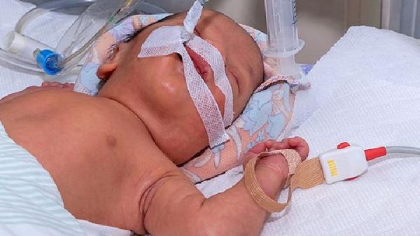寶寶輔食如何選擇？嬰兒輔食食譜