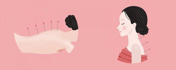 針灸減肥20斤需要多久