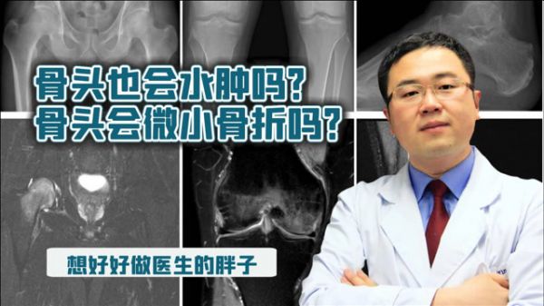 Thumbplayer Poster Plugin Image