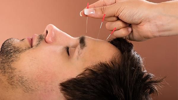 針灸是如何瘦身的？