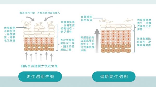 果酸煥膚原理