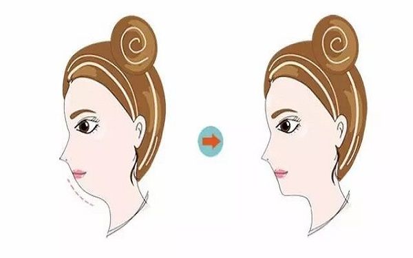 維密模特的身材標(biāo)準(zhǔn)和要求是什么？成為維密模特需要滿足哪些條件？