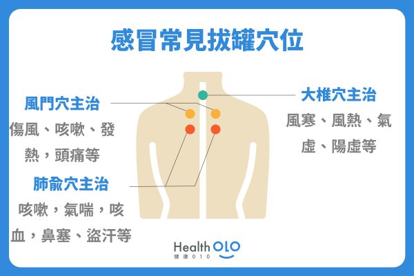 感冒常見拔罐穴位