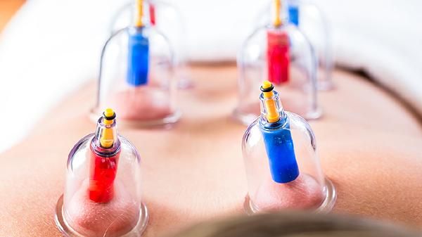 拔罐的作用與好處