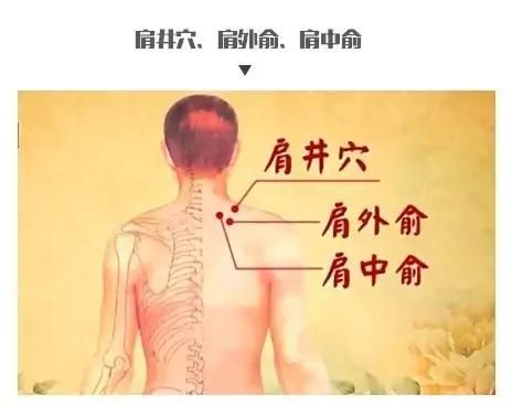 拔罐雖好并非人人都適宜，怎樣合理根據(jù)體質(zhì)來拔罐？