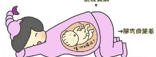 纠正臀位用什么姿势