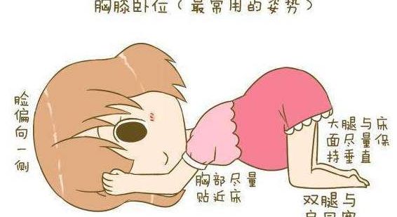 膝胸卧位操纠正