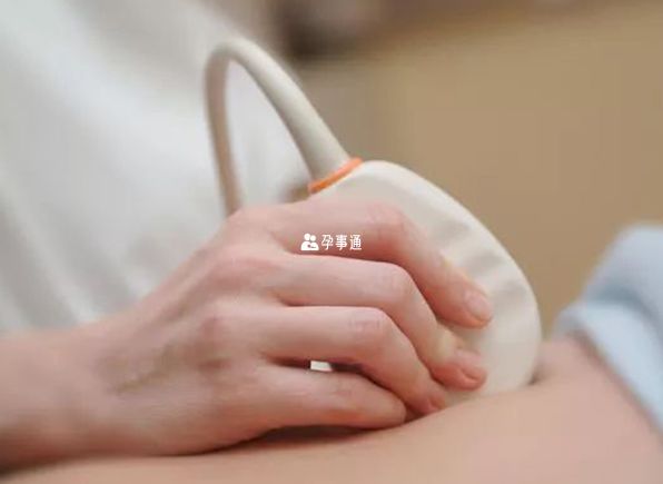 孕妇长期用电磁炉对胎儿有影响