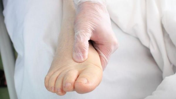 吃什么藥可以消水腫