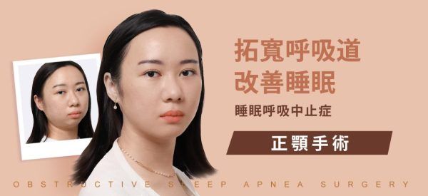 做过拔牙矫正，因为呼吸中止再做正颚手术